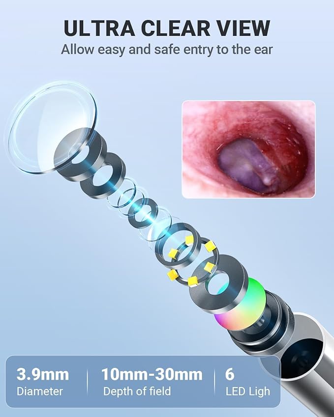 Anykit Digital Otoscope with Gyroscope, 4 Inches Screen, 3.9mm Ear Scope Camera with 6 Lights, Ear Wax Removal Tool, 32GB Card, Supports Photo Snap and Video Recording