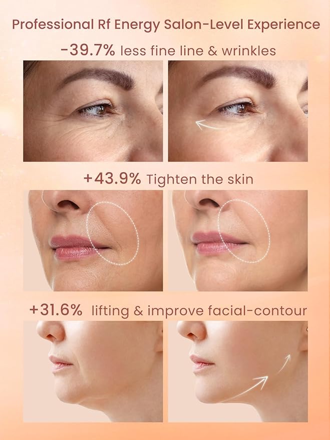 RF Radio Frequency Facial Device, 1MHz RF Machine for Anti-Aging & Face Lifting, Wireless Skin Tightening for Wrinkles & Jawline, 3 Modes for Home Use with Gel