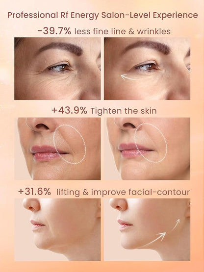 RF Radio Frequency Facial Device, 1MHz RF Machine for Anti-Aging & Face Lifting, Wireless Skin Tightening for Wrinkles & Jawline, 3 Modes for Home Use with Gel