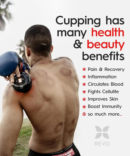 REVO The Original 4-in-1 Smart Cupping Therapy Massager, Red Light Therapy for Targeted Pain Relief, Knots, Aches, Muscle Soreness, Circulation & Tighter Skin, Portable Cupping Kit