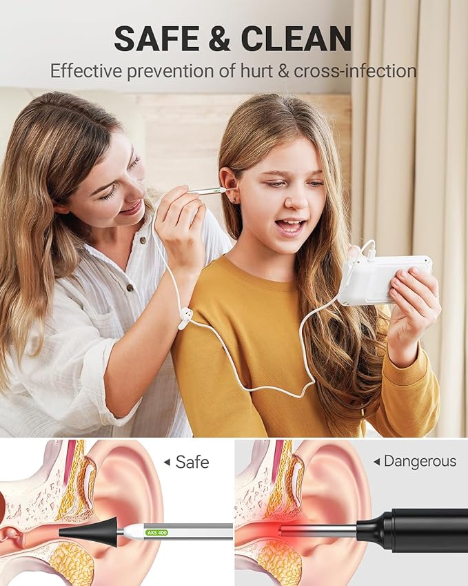 Anykit Digital Otoscope with Gyroscope, 4 Inches Screen, 3.9mm Ear Scope Camera with 6 Lights, Ear Wax Removal Tool, 32GB Card, Supports Photo Snap and Video Recording
