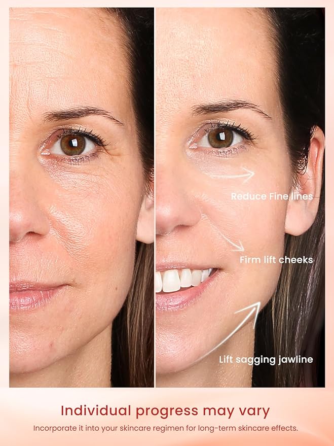 RF Radio Frequency Facial Device, 1MHz RF Machine for Anti-Aging & Face Lifting, Wireless Skin Tightening for Wrinkles & Jawline, 3 Modes for Home Use with Gel