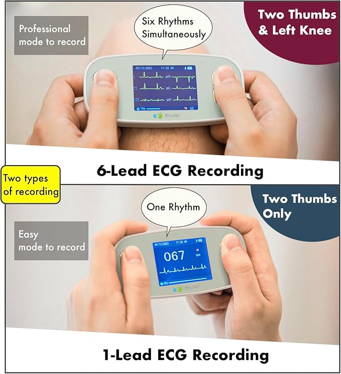 EMAY 6L Portable ECG Monitor | Record ECG and Heart Rate in 6 Channels | Compatible with Smartphone and PC | No Subscription Required